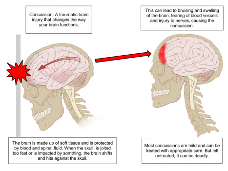 We create and design experiments to investigate brain injury mechanisms due to both blast and blunt impact.